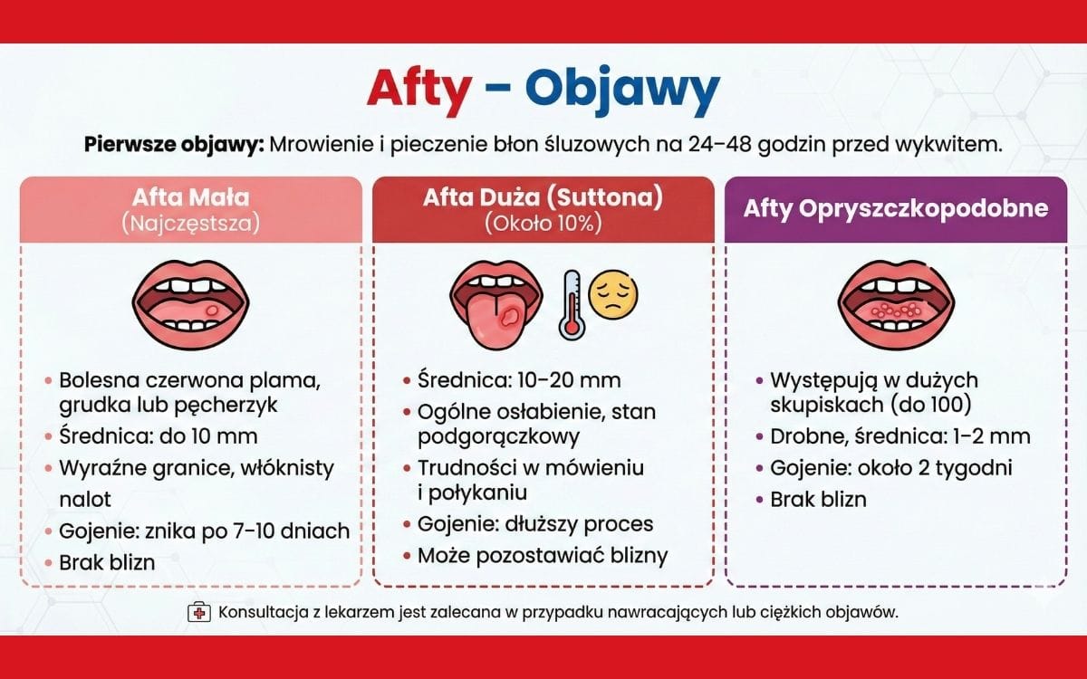 Infografika medyczna „Afty – objawy”. Grafika opisuje wczesne objawy (pieczenie i mrowienie 24-48h przed wykwitem) oraz dzieli afty na trzy rodzaje: 1. Afty małe (do 10mm, goją się 7-10 dni bez blizn); 2. Afty duże Suttona (10-20mm, mogą powodować gorączkę i pozostawiać blizny); 3. Afty opryszczkopodobne (liczne skupiska drobnych zmian do 1-2mm).