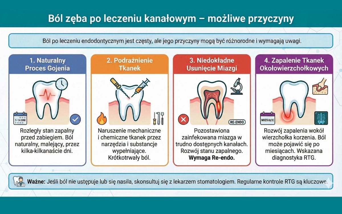 Infografika medyczna zatytułowana 'Ból zęba po leczeniu kanałowym – możliwe przyczyny'. Grafika podzielona jest na cztery panele wyjaśniające źródła bólu: 1. Naturalny proces gojenia (malejący ból trwający kilka-kilkanaście dni, spowodowany wcześniejszym stanem zapalnym); 2. Podrażnienie tkanek (krótkotrwały ból wywołany mechanicznym i chemicznym działaniem narzędzi i substancji); 3. Niedokładne usunięcie miazgi (rozwój stanu zapalnego w trudno dostępnych kanałach, wymagający re-endo); 4. Zapalenie tkanek okołowierzchołkowych (ból pojawiający się nawet po miesiącach, wymagający diagnostyki RTG). Pasek na dole przypomina o konieczności konsultacji z dentystą, jeśli ból nie ustępuje.