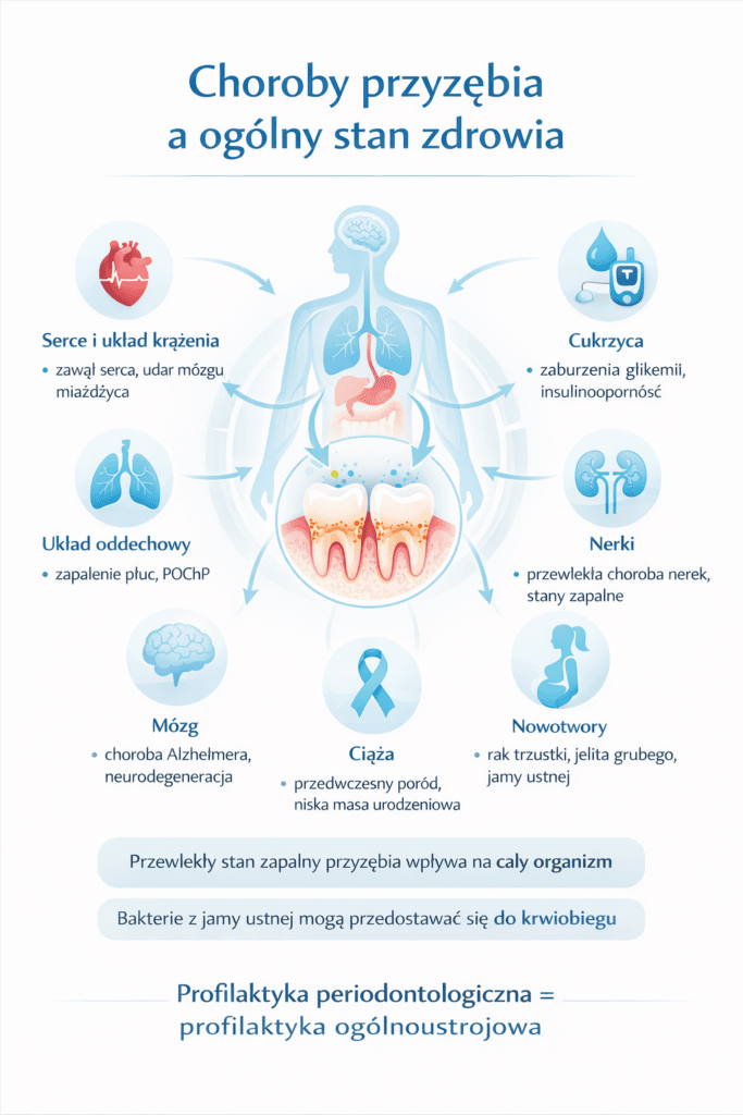 Infografika „Choroby przyzębia a ogólny stan zdrowia” przedstawiająca wpływ stanów zapalnych w jamie ustnej na różne narządy. Wymienia powiązania z chorobami serca, cukrzycą, nerkami, nowotworami, problemami z ciążą, mózgiem i układem oddechowym.